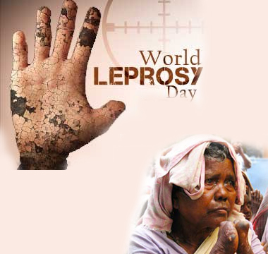 Jan 30 - World Leprosy Day